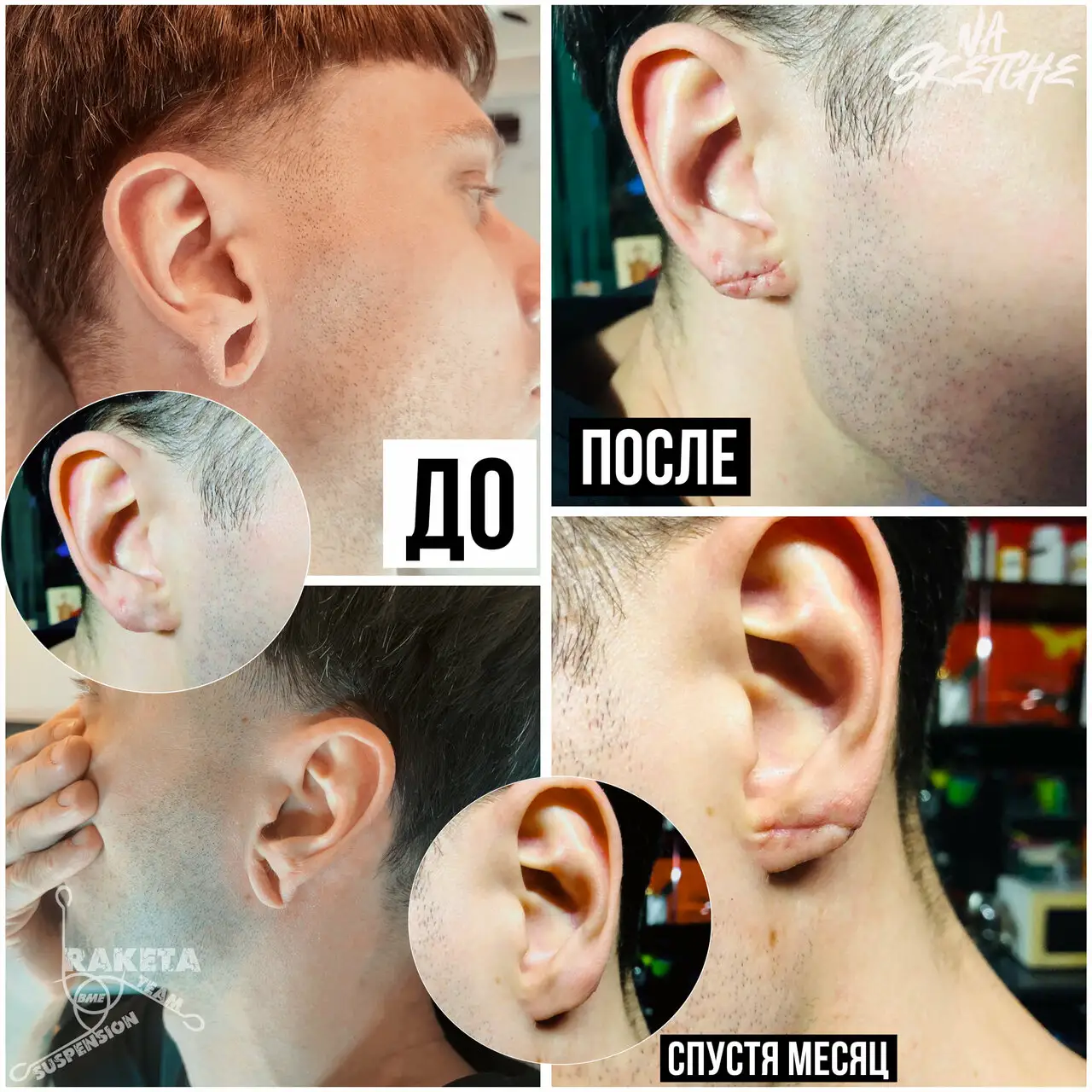 Зашивание ушей, работа мастера